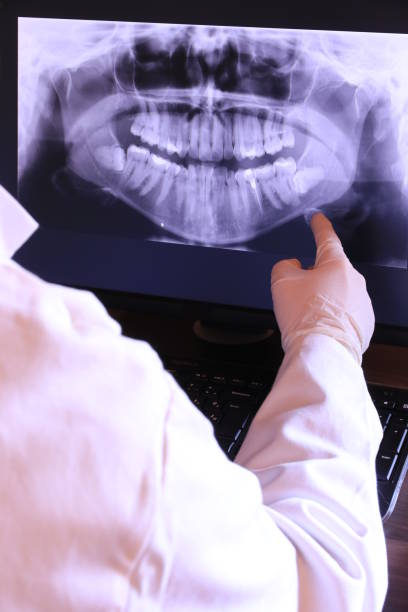 Best Emergency Tooth Extraction in Tignall, GA